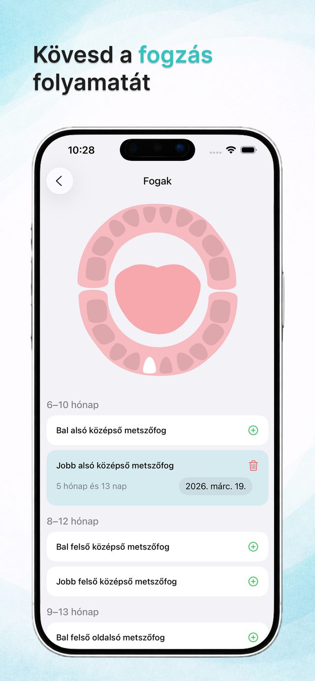 Interaktív fogtérkép